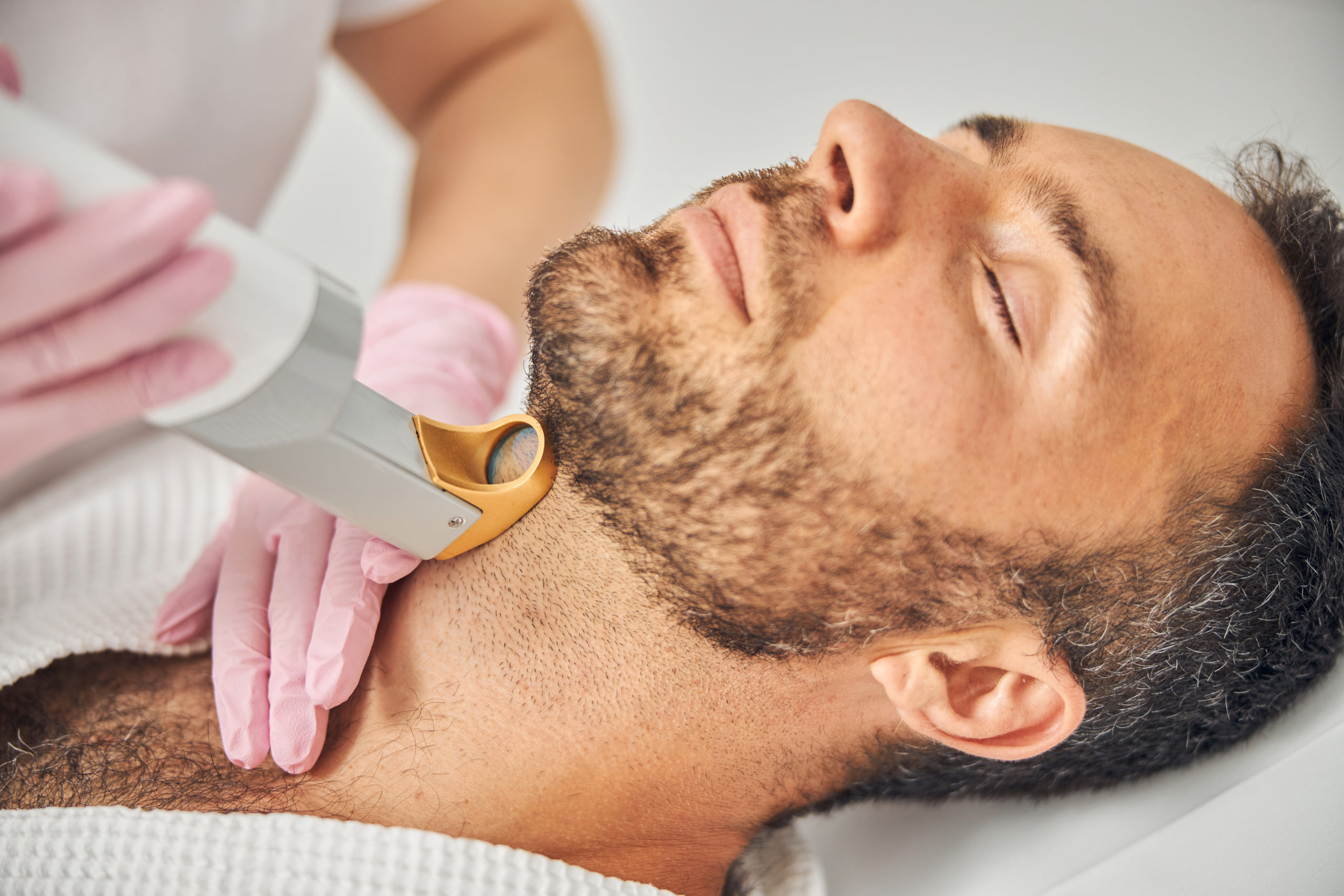Ditch the Neck Hair: Laser Hair Removal for Men - Plastic Surgery Associates